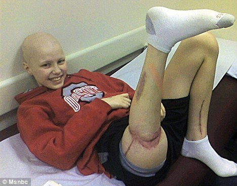 INSPIRING STORY: THE BOY WITH THE BACKWARD LEG